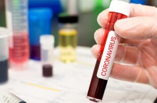 Coronavirus Patient In France Suffers 4-Hour Erection From Blood Clots