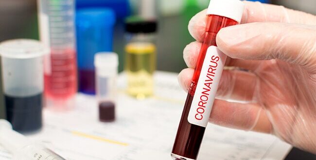 Coronavirus Patient In France Suffers 4-Hour Erection From Blood Clots