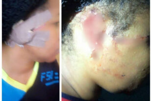 Husband bites off his wife's ear in Niger state.